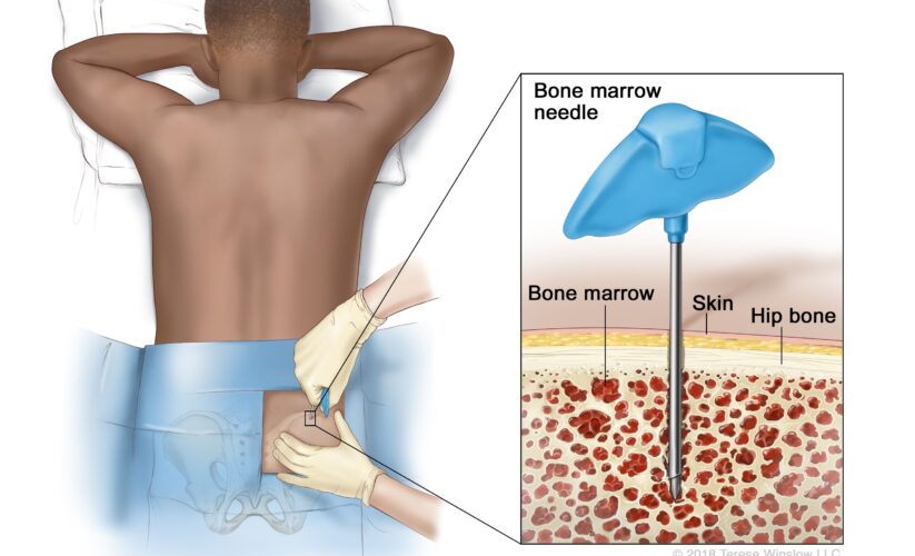 Best 5 Ways to Cook Bone Marrow for a Delicious Meal in 2025