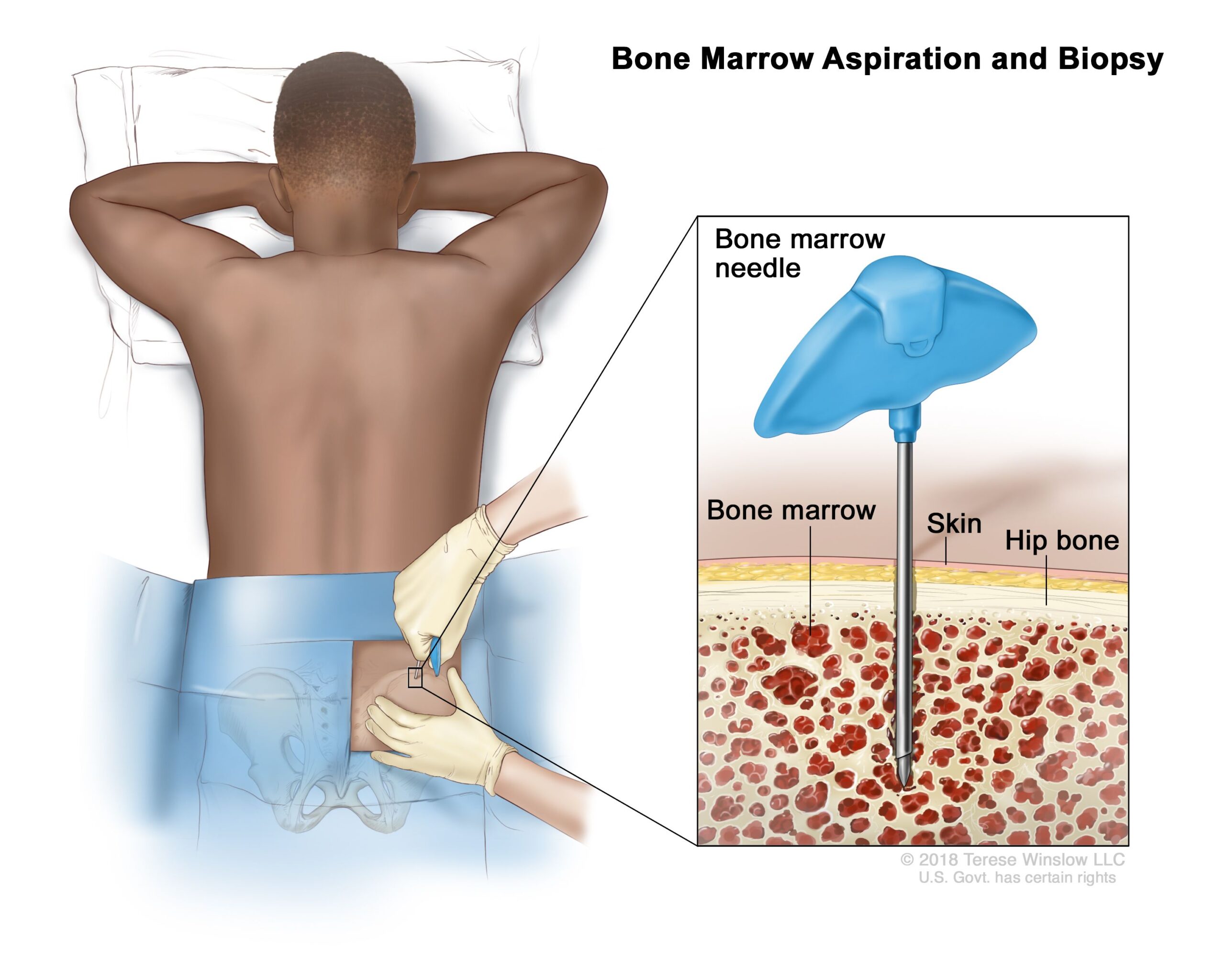 Best 5 Ways to Cook Bone Marrow for a Delicious Meal in 2025