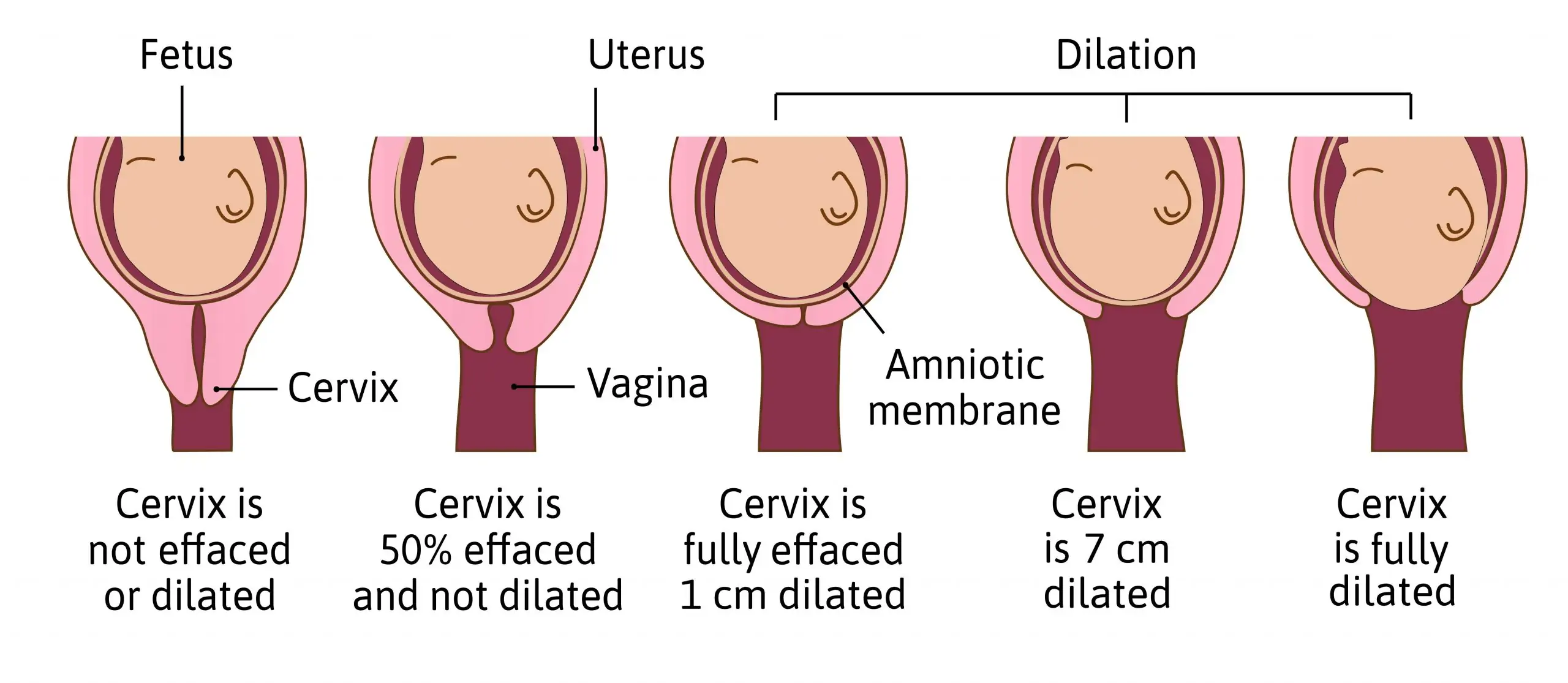 Effective Ways to Understand If You’re Dilating in 2025: Discover the Signs!